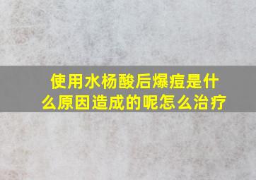 使用水杨酸后爆痘是什么原因造成的呢怎么治疗