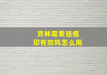 克林霉素祛痘印有效吗怎么用