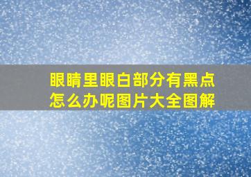 眼睛里眼白部分有黑点怎么办呢图片大全图解